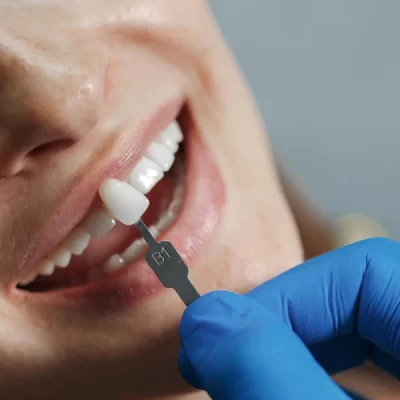 dentista-clareando-os-dentes_624325-1916